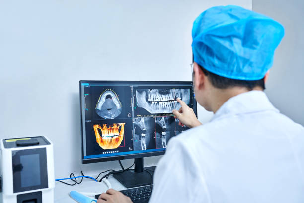 Best Emergency Tooth Extraction in Morn, GA